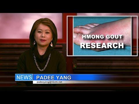 3HMONGTV NEWS: Hmong gout research studies, first in the state, to help treat gout patients.
